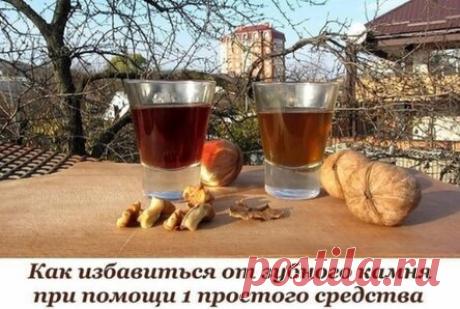 1 классный способ избавиться от зубного камня самому и дома!