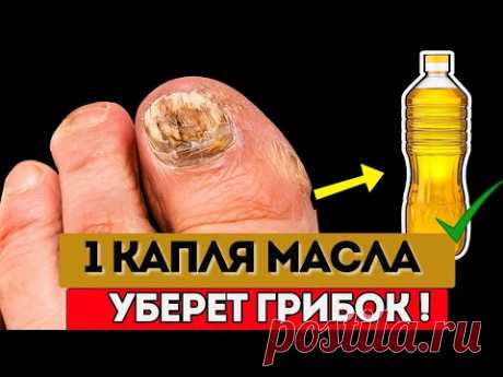 Грибок исчезает! Капля масла и ноготь становится чистым. ВРАЧИ В ШОКЕ !