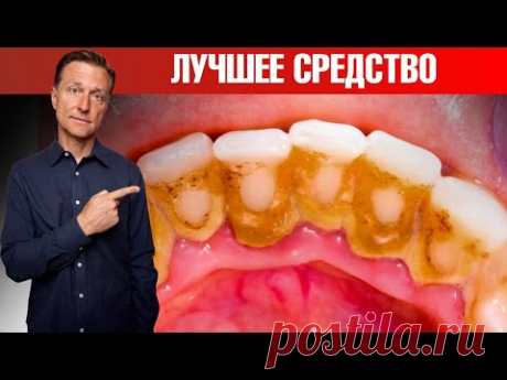 Зубной налет и зубной камень? Лучшее средство! Сделайте сами🙌