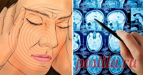9 симптомов, которые указывают на то, что у вас уже был микроинсульт и вскоре может быть следующий! - Я Здоров Инсульт — распространенное заболевание не только среди пожилых людей, но и среди молодежи. Неправильное питание и режим дня, стрессы на работе и учебе приводят к возникновению микроинсульта, который имеет серьезные последствия!Профилактика всегда является лучшим лекарством, и мы поможем вам в этом. Знание ранних симптомов инсульта может спасти вашу жизнь. Инсульт ...