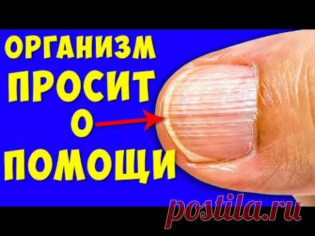 Необратимые процессы Дефицита белка, Не игнорируйте эти Симптомы! Что делать и как избавиться