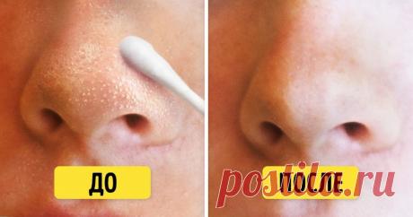 10 натуральных средств, которые спасут лицо от черных точек