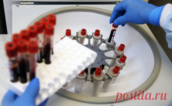 Песков назвал не вопросом Кремля тестирование иностранцев на инфекции. Оценка закона о тестировании иностранных специалистов на инфекционные заболевания, передающиеся половым путем, не является прерогативой Кремля, это вопрос миграционных властей.