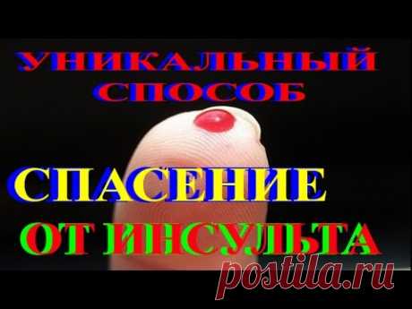 СПАСТИСЬ ОТ ИНСУЛЬТА.УНИКАЛЬНЫЙ МЕТОД.ЭТО НАДО ЗНАТЬ ВСЕМ