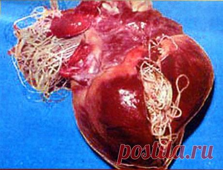 Глисты: симптомы