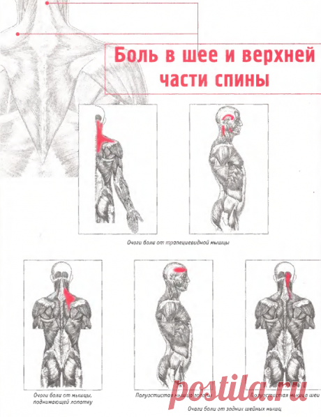Боль в шее и верхней части спины