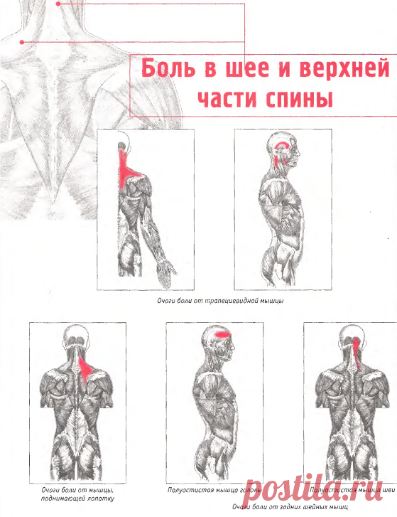 Боль в шее и верхней части спины