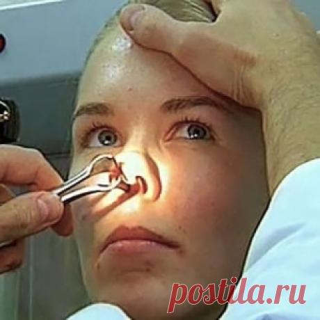 Меры профилактики заболевания гайморит