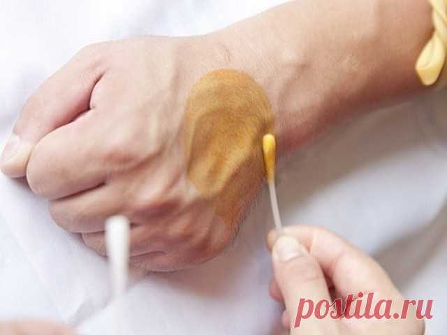 ТАКОЙ ПОЛЕЗНЫЙ ЙОД  - посмотрите на себя в зеркало! Белый йод..

Помощь организму. Как правильно применять белый йод

Читаем внимательно! Есть нюансы, которые надо учитывать!

Сухость кожи, тусклость, выпадение волос, ломкость ногтей, отёчность, одутловатость лица, потухшие глаза, усталость, сонливость, плаксивость и т.д. — это всё нехватка йода в организме. Еcли йода в организме хватает — у женщины глаза блестят! Летать хочется!



Опасность нехватки этого микроэлемента в...