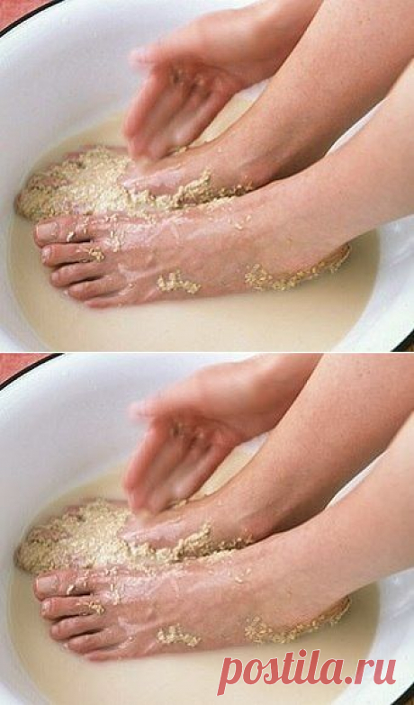 Мозоли.трещинки