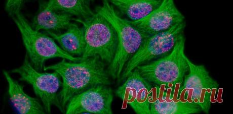 Временное «старение» раковых клеток, вызванное химиотерапией, может приводить к рецидиву
Даже успешная поначалу борьба с раковой опухолью может закончиться поражением: болезнь может вернуться. Один из базовых естественных механизмов предотвращения онкологических болезней – «запрет на размножение» для стареющих, изношенных клеток, которые могут стать родоначальниками опухоли. Однако и раковые...
Читай пост далее на сайте. Жми ⏫ссылку выше