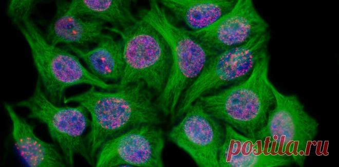 Временное «старение» раковых клеток, вызванное химиотерапией, может приводить к рецидиву
Даже успешная поначалу борьба с раковой опухолью может закончиться поражением: болезнь может вернуться. Один из базовых естественных механизмов предотвращения онкологических болезней – «запрет на размножение» для стареющих, изношенных клеток, которые могут стать родоначальниками опухоли. Однако и раковые...
Читай пост далее на сайте. Жми ⏫ссылку выше