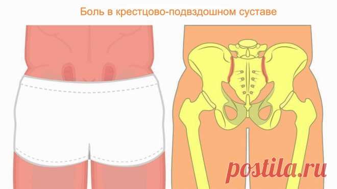 Крестцово-подвздошный сустав. Как разблокировать SI сустав