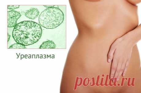 Лечим дома: уреаплазмоз
