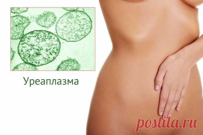 Лечим дома: уреаплазмоз
