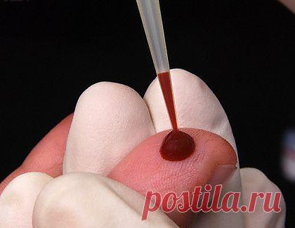 Кровопускание.Спасение от инсульта..