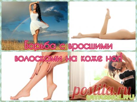 Вросшие волосы на коже ног: лучшие варианты решения проблемы!