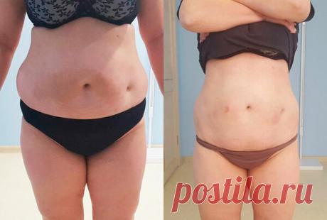 Аптечное средство за 30 рублей помогло мне избавиться от возрастного жира в 52 года за один месяц

В свои 20 лет я была спортсменкой с идеальной фигурой. Стройные ноги, плоский живот были всегда со мной. Постоянные тренировки,только правильное питание,никакого стресса .

Но возраст даёт о себе знать да и жизненные ситуации,связанные со стрессом препятствуют сохранению идеальной фигуры и крепкого здоровья. К вопросу похудения я подошла серьезно.