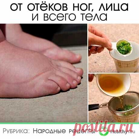 Здоровье | Healthy You в Instagram: «ОТ ОТЁКОВ НОГ, ЛИЦА И ВСЕГО ТЕЛА ᅠ Сохраните себе 💾 ᅠ 1. Смесь трех лимонов с кожурой и 125 грамм хрена, прокрученных через мясорубку.…» Здоровье | Healthy You поделился(-ась) публикацией в Instagram : “ОТ ОТЁКОВ НОГ, ЛИЦА И ВСЕГО ТЕЛА ᅠ Сохраните себе 💾 ᅠ 1. Смесь трех лимонов с кожурой и 125 грамм…” • Подпишитесь на него/нее, что просмотреть 5,353 публикаций.