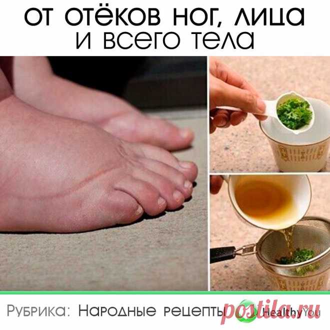 Здоровье | Healthy You в Instagram: «ОТ ОТЁКОВ НОГ, ЛИЦА И ВСЕГО ТЕЛА ᅠ Сохраните себе 💾 ᅠ 1. Смесь трех лимонов с кожурой и 125 грамм хрена, прокрученных через мясорубку.…» Здоровье | Healthy You поделился(-ась) публикацией в Instagram : “ОТ ОТЁКОВ НОГ, ЛИЦА И ВСЕГО ТЕЛА ᅠ Сохраните себе 💾 ᅠ 1. Смесь трех лимонов с кожурой и 125 грамм…” • Подпишитесь на него/нее, что просмотреть 5,353 публикаций.