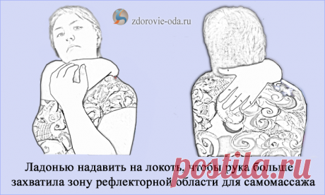 Как убрать холку на шее: методы массажа и упражнений