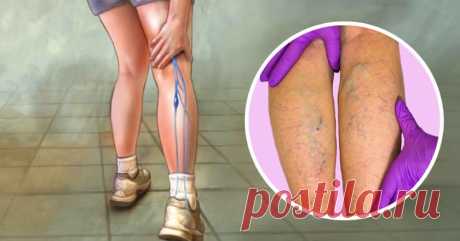 5 причин возникновения тромбоза и упражнения для решения этой проблемы