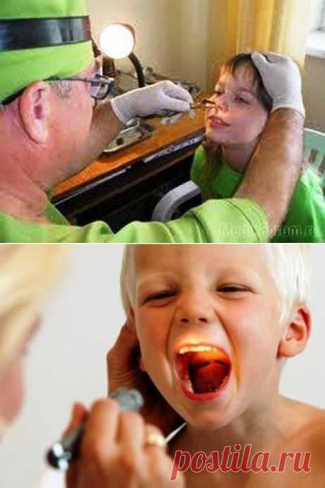 Что нужно знать об аденоидах » Время новостей