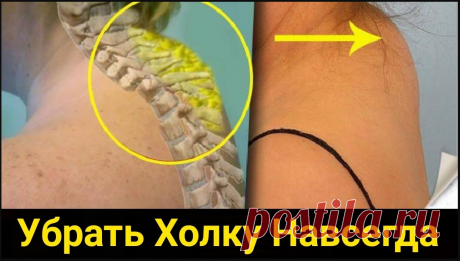 Болит вдовий горбик у женщин