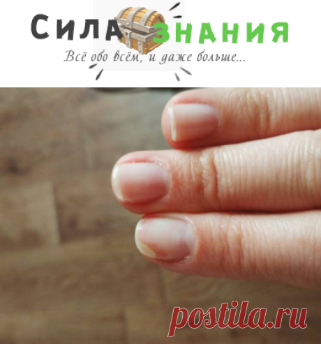 Онихолизис ногтей на руках: причины и лечение после гель лака