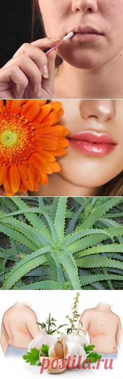 Народные средства лечения герпеса