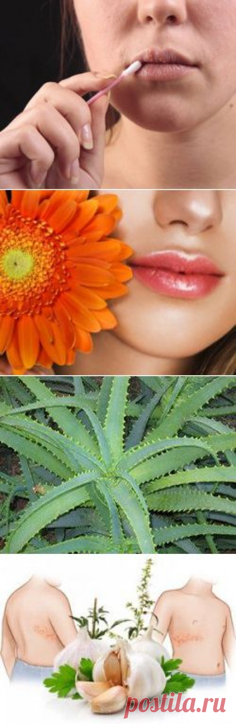 Народные средства лечения герпеса