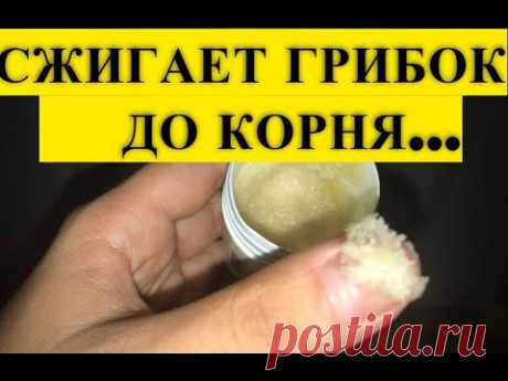 Эта ЯДРЕНАЯ Мазь, Съедает Ногтевой Грибок До Самого Корня! Есть в Любой Аптеке..