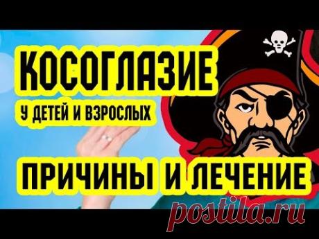 Косоглазие у детей и взрослых. Причины и лечение | Восстановление зрения