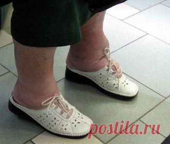 инфо-БУМ: Отеки ног. Народные методы лечения отеков ног