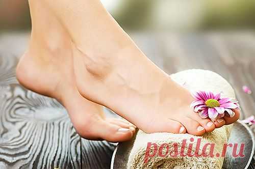 Лечение подагры на ногах