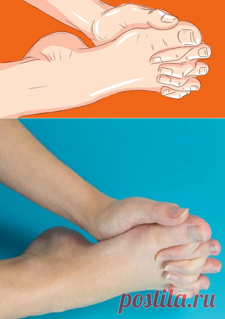 Упражнения для стоп
