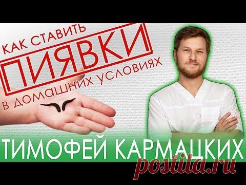 ПИЯВКИ. КАК СТАВИТЬ в домашних условиях? Тимофей Кармацкий