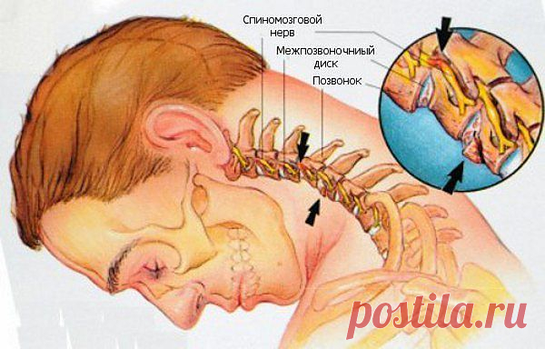 Профилактика остеохондроза (отличное упражнение).