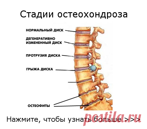 стоимость эмт грудных позвонков: 10 тыс изображений найдено в Яндекс.Картинках