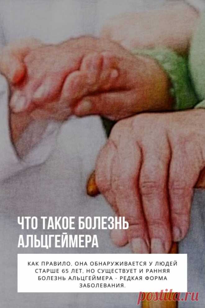 Болезнь Альцгеймера (также сенильная деменция альцгеймеровского типа) — наиболее распространённая форма деменции, неизлечимое дегенеративное заболевание, впервые описанное в 1906 году немецким психиатром Алоисом Альцгеймером. Как правило, она обнаруживается у людей старше 65 лет, но существует и ранняя болезнь Альцгеймера — редкая форма заболевания. Общемировая заболеваемость на 2006 год оценивалась в 26.6 млн человек, а к 2050 году число больных может вырасти вчетверо.
