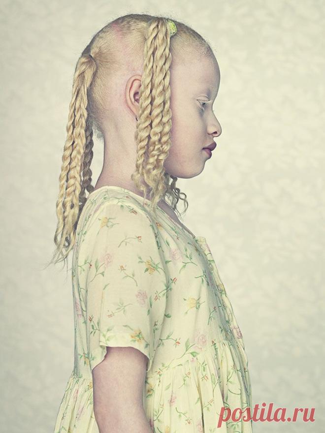 Альбиносы / Путешествия / Моя Планета.....