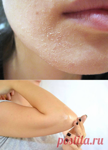 Когда организм просит о помощи: 15 важных сигналов