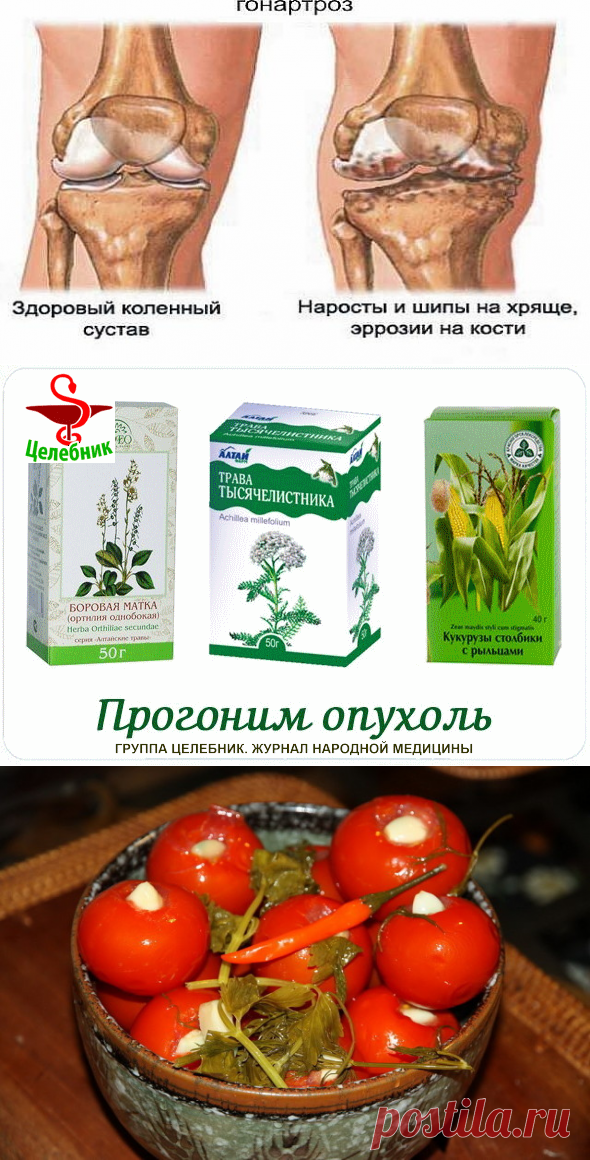 (1) Одноклассники     Аспириновый мёд” от боли в коленях