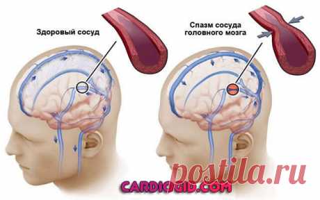 Спазмолитики: список препаратов для кишечника, болях в спине, голове, сердце Список препаратов спазмолитиков, для ЖКТ, при боли в голове, животе, сердце, классификация и механизм действия, показания и побочные эффекты.