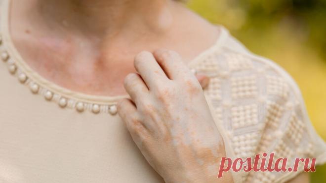 Названы неочевидные причины возникновения пигментных пятен на коже. Пигментные пятна могут появляться на коже не только из-за воздействия солнца, но и на фоне гормональных колебаний, внутренних нарушений организма или неправильно подобранного ухода. Об этом Pravda.Ru рассказала косметолог и бьюти- эксперт ...