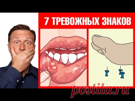 7 тревожных симптомов дефицита витамина В12⭕️