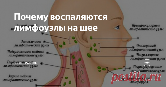 Почему воспаляются лимфоузлы на шее Часто как взрослые, так и дети обнаруживают на шее болезненные выпуклости, которых там быть не должно. Так проявляют себя воспаленные лимфоузлы, которые у каждого человека расположены во многих местах, в том числе и на шее. Стоит ли сразу же обращаться к врачу, если вы обнаружили, что воспалился лимфоузел на шее? В чем могут быть причины этого явления и чем оно грозит?