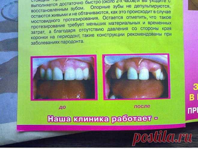 лучше чем до аварии!