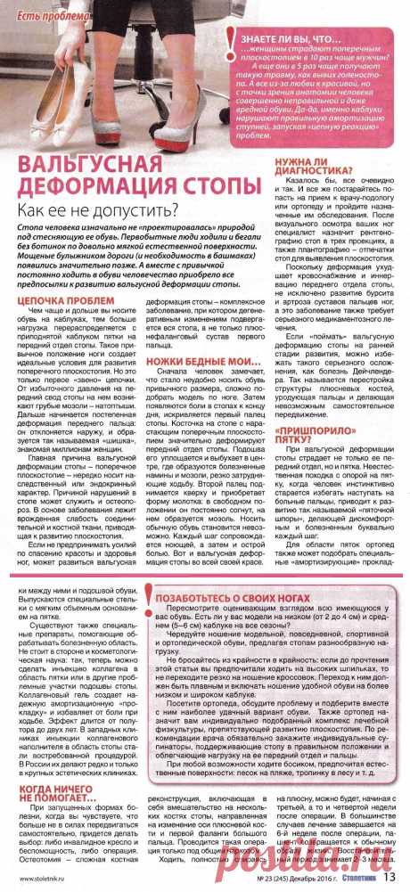 Вальгусная деформация стопы