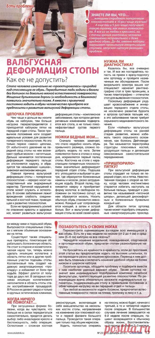 Вальгусная деформация стопы